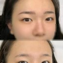 엘케이헤어(LK)