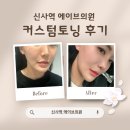 신사역 에이브의원에서 커스텀토닝 받고 온 찐 후기