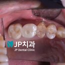 필치과기공소 네이버블로그