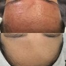 나티나 | 내 피부 고민, '부평피부관리'에서 맞춤 상담으로 해결했어요!