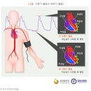 혈압에 대해서 생각해 볼까요? 이미지