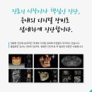 미아동치과, 디지털 임플란트 시술이란? 이미지