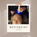 [천안 탈모/ 두피 관리] 탈모 고민 해결!! 웰킨두피센터 천안신불당점 탈모 관리 솔직 후기