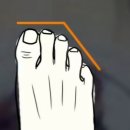 나의발 이미지