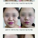 강남뷰티의원 이미지