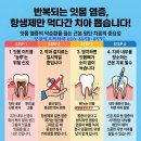 못난이 잇몸일으켜 치약 나눔합니다. 잇몸 건강에 필요하신 10분께 드립니다. 이미지