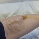 중산바른신경외과의원 | 오른쪽 눈밑떨림 원인 증상기록 병원방문후기 / 바른에스신경외과의원