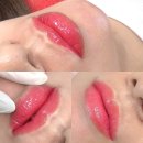 1284 | 수원입술문신 더봄뷰티 솔직 후기, 믿고 맡길 수 있었던 이유