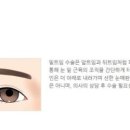 센트럴성형외과