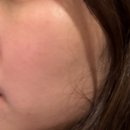 잠실 방이동 에스테틱 피부관리샵 추천 :: 루미나에스테틱 물폭탄관리 후기