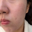 호텔더루아 | 송파피부관리 문정 루아에스테틱 물광 베이직 케어 솔직 후기