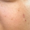 마이비타 - 양평군 | 트리마이 멀티케어 겔 아이패치 인리치드 비타브라이트 사용 후기