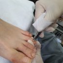 키스네일 네이버블로그
