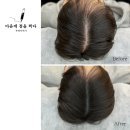 김정화헤어라인 티스토리