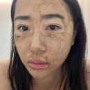 필링 | 알라딘필링 후기 1일차-5일차 각질과 꾸밈없는 찐후기