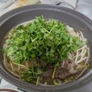 &lt;30주 5일&gt;임산부 감기 수액맞고 감기약 처방(산부인과)