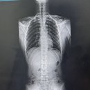 애프터짐 이미지