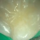 사직어린이치과
