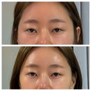 리스빌 | 논현얼굴관리 김도영 체형관리에서 맞춤관리 받고 온 후기