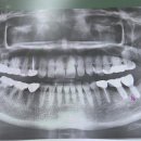 상남으뜸플란트치과의원 이미지