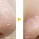 로담한의원(가산금천점) 네이버블로그