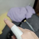 제일정형외과의원 | [충남/당진] 손가락 염좌로 내돈내산 솔직후기 :: 당진 효자 정형외과