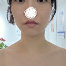 뷰티퀸 스킨케어 - 서구 | 뷰티퀸 스킨케어