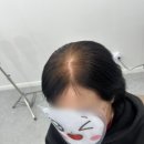 여우가발모심위그 | 일산 가발 정수리 탈모와 흰머리 고민 해결한 여우가발모심위그 일산점 방문기