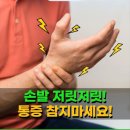 손**-7 이미지