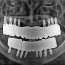 김준태 | 일곡동 치과 추천, 아직도 후기만 보고 계세요?