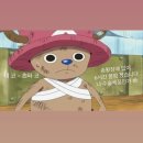 부산 서면 무보형 자가연골 첫 코성형 후기 | 매부리코 | 휜코 | 비중격교정술 | 수술 0일차 ~ n일차...