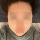 대연상가 | 대연 피부관리 [올가드림뷰티] - 자극없이 개운한 모공디톡스 후기