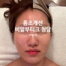 비알부티크 이미지