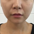 바라던 핏 이미지