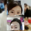 김영숙헤어라인 이미지