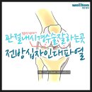 [전방십자인대파열 & 관절내시경] 전방십자인대파열로 인한 관절내시경 @ 자주하는 질의 & 응답!! 이미지