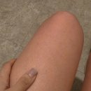 왕십리 에르모 크라이오테라피 가격 효과 부작용 없는 3주 다이어트 후기
