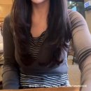 분회 | 신사지방분해주사 복부, 팔뚝 마지막 5회차 전후비교 최종 감량 후기