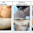 토실 프로젝트