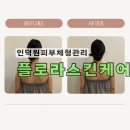 플로라스킨케어 - 안양시 동안구 | 안양예신관리 얼굴비대칭 잘잡는 플로라스킨케어 시크릿윤곽관리 후기