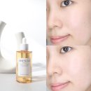 1004 | 디렉터파이’s pick 수부지 피부 속건조 잡아줄 올리브영 앰플 추천 스킨1004 후기