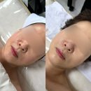 오블리에 | 대구 동구 피부관리 오블리제이에서 에어쎈 올인원 관리 받고 온 후기