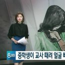 "자는데 깨웠다고" 중학생, 스승 위에 올라타 마구 폭행해 교사 안면함몰.... 이미지