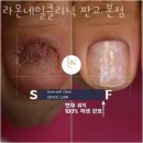 성남네일샵 라온네일클리닉 판교 본점 가격문의