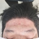 털공장 | 🔥 남편이 받고 감탄한 상봉 왁싱 털공장 헤어라인 왁싱 리얼 후기! 🔥