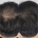 수원 영통 아이라인 잘하는 세종뷰티 수원영통점 후기