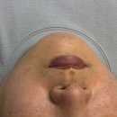 청담리브의원 | 상봉역 에스테틱 리브르 오빠도 반한 피부관리샵 💆‍♀️ 상봉역 리브르 아쿠아필링 리얼 후기 ::