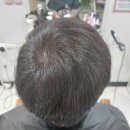 이삼칠 염색 두피관리