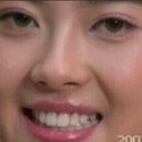 방범골뱅이 이미지