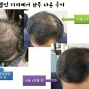 디피케어